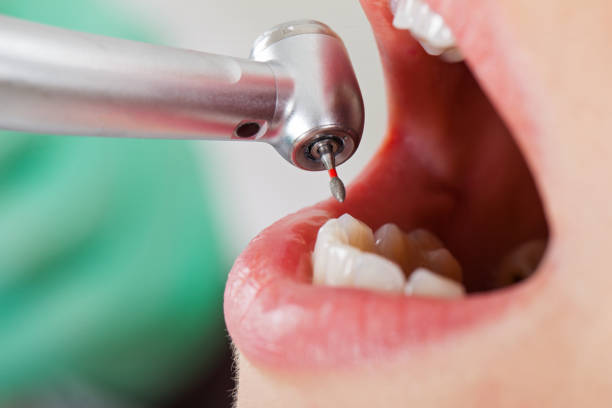 Best Emergency Dentist for Knocked-Out Tooth in Yardville, NJ